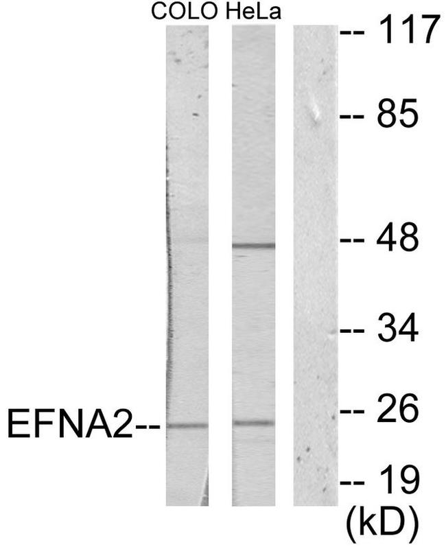 Ephrin A2 Antibody in Western Blot (WB)