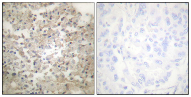 Phospho-TPH1 (Ser260) Antibody in Immunohistochemistry (Paraffin) (IHC (P))