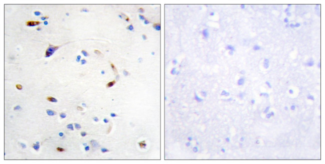 ZEB2 Antibody in Immunohistochemistry (Paraffin) (IHC (P))