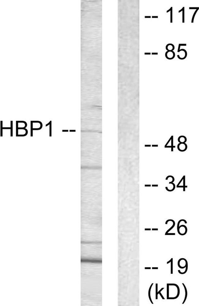HBP1 Antibody in Western Blot (WB)