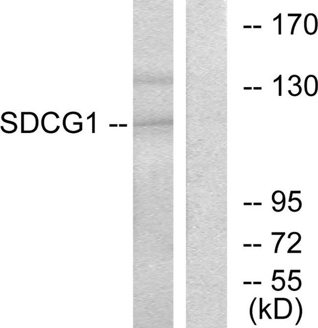 NEMF Antibody in Western Blot (WB)