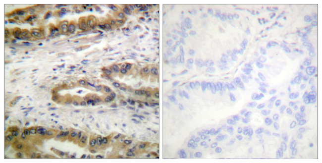 Phospho-VEGF Receptor 2 (Tyr1054) Antibody in Immunohistochemistry (Paraffin) (IHC (P))