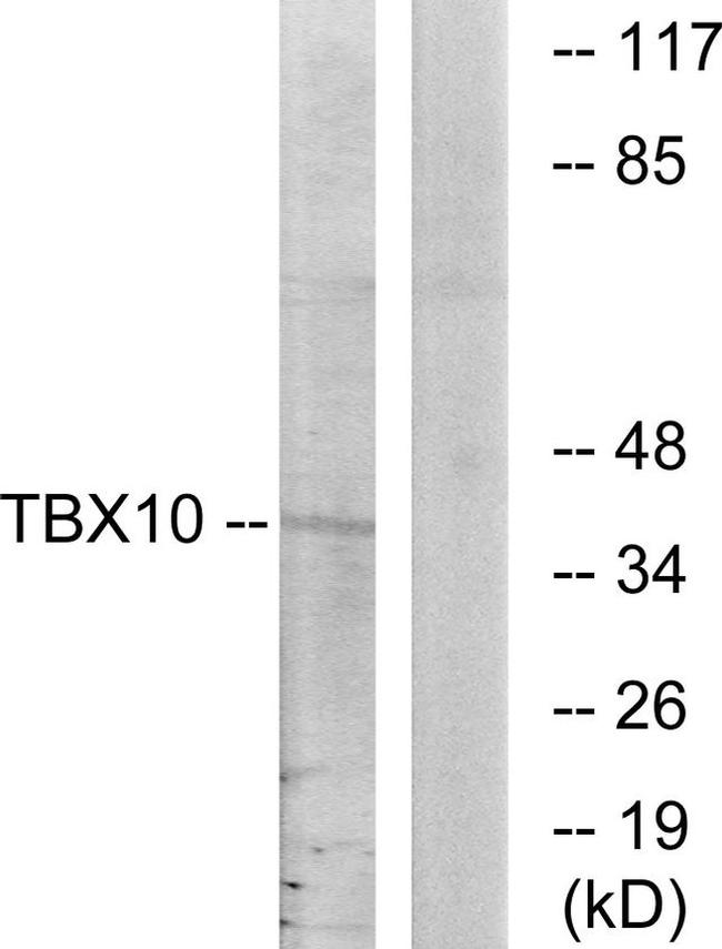 TBX10 Antibody in Western Blot (WB)
