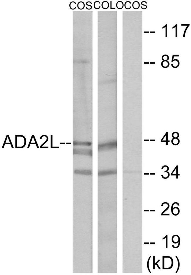 TADA2L Antibody in Western Blot (WB)