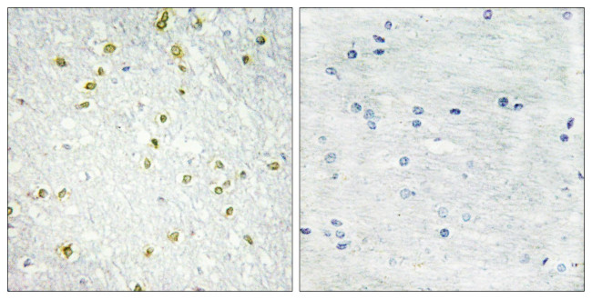 SNAPC5 Antibody in Immunohistochemistry (Paraffin) (IHC (P))