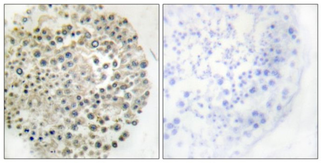 TRIM16 Antibody in Immunohistochemistry (Paraffin) (IHC (P))