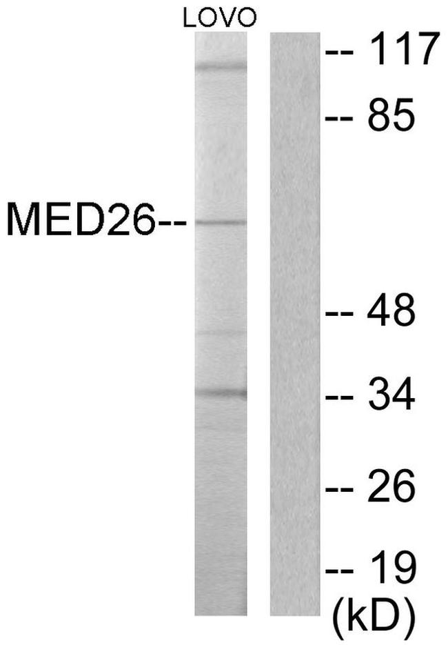 MED26 Antibody in Western Blot (WB)