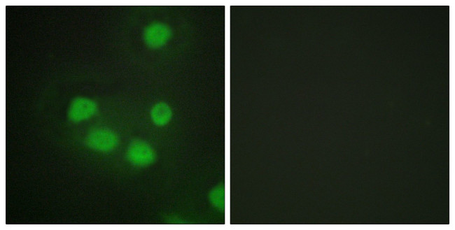 SIX6 Antibody in Immunocytochemistry (ICC/IF)
