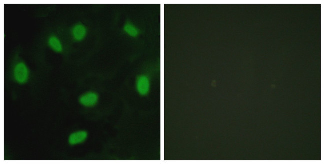 TBX15/TBX18 Antibody in Immunocytochemistry (ICC/IF)