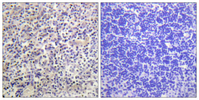 HBP1 Antibody in Immunohistochemistry (Paraffin) (IHC (P))