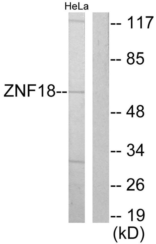 ZNF18 Antibody in Western Blot (WB)