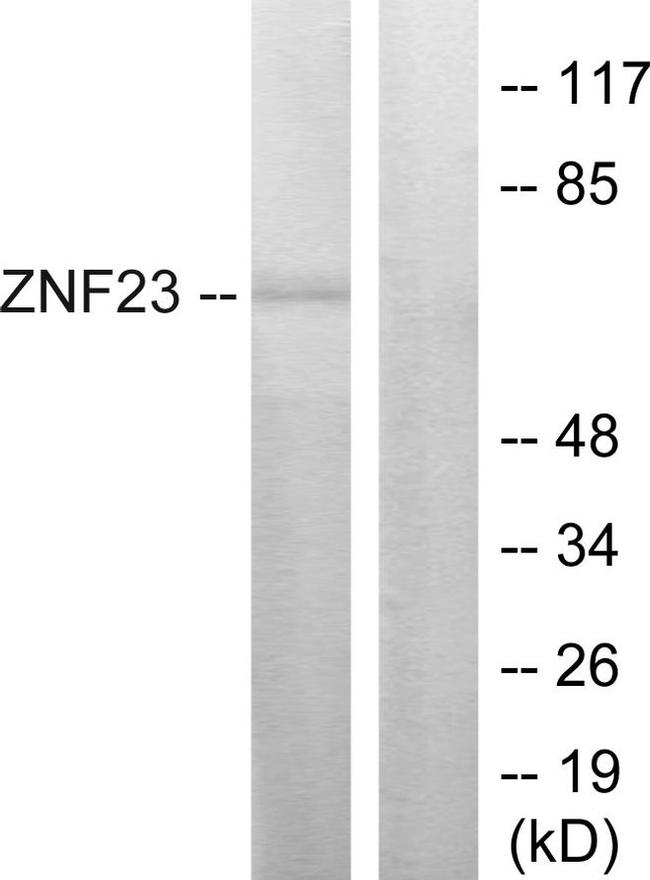 ZNF23 Antibody in Western Blot (WB)