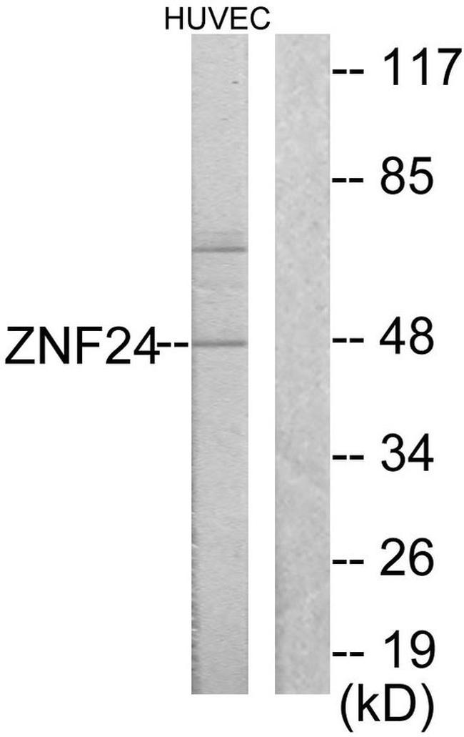 ZNF24 Antibody in Western Blot (WB)