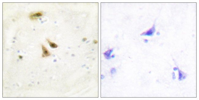 UBF-1 Antibody in Immunohistochemistry (Paraffin) (IHC (P))