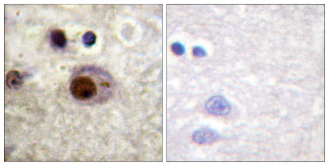 Phospho-hnRNP C (Ser260) Antibody in Immunohistochemistry (Paraffin) (IHC (P))
