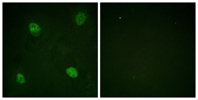 Phospho-hnRNP D (Ser83) Antibody in Immunocytochemistry (ICC/IF)