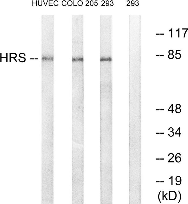 HGS Antibody in Western Blot (WB)