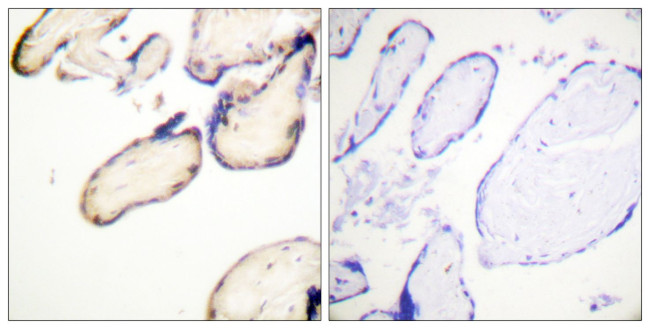 Phospho-Cdc37 (Ser13) Antibody in Immunohistochemistry (Paraffin) (IHC (P))