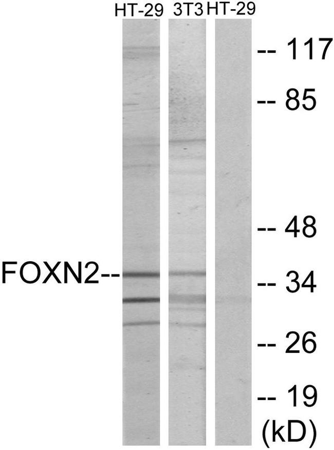 FOXN2 Antibody in Western Blot (WB)