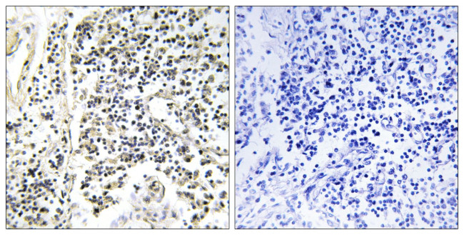 Phospho-IkB alpha (Tyr305) Antibody in Immunohistochemistry (Paraffin) (IHC (P))