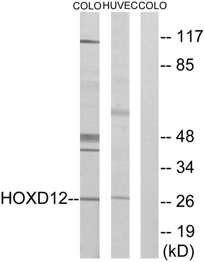 HOXD12 Antibody in Western Blot (WB)