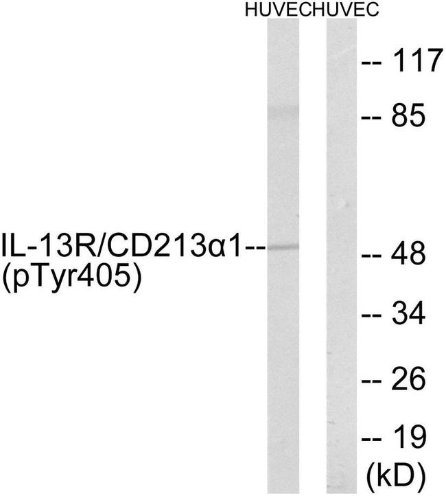 Phospho-IL13RA1 (Tyr405) Antibody in Western Blot (WB)