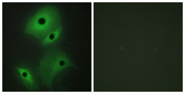 NBL1 Antibody in Immunocytochemistry (ICC/IF)