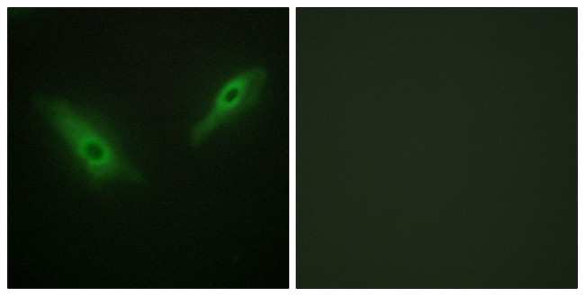 PHKA1/PHKA2 Antibody in Immunocytochemistry (ICC/IF)