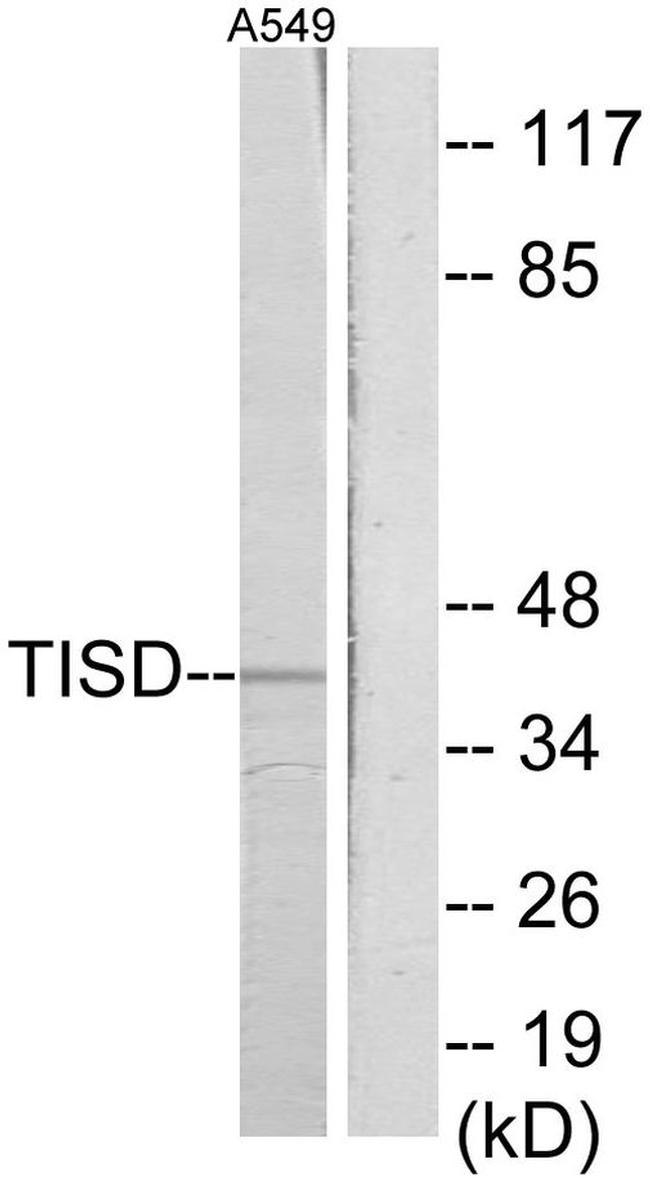 TIS11D Antibody in Western Blot (WB)