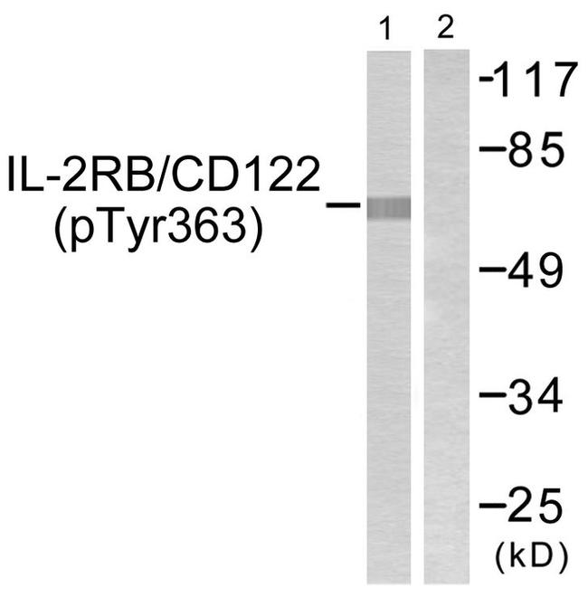 Phospho-CD122 (Tyr364) Antibody in Western Blot (WB)