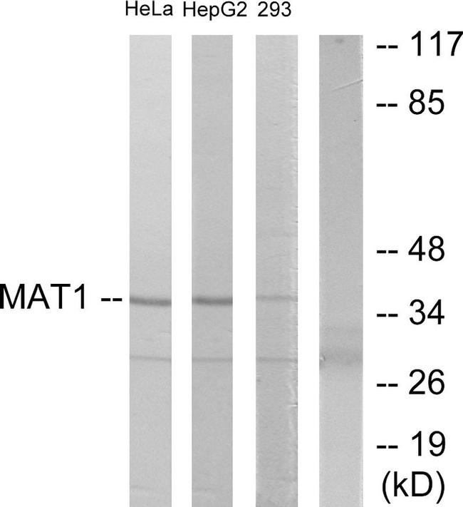 MNAT1 Antibody in Western Blot (WB)