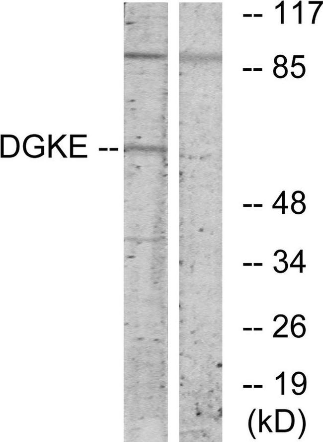 DGKE Antibody in Western Blot (WB)