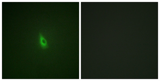 Phospho-IP3 Receptor 1 (Ser1588, Ser1598) Antibody in Immunocytochemistry (ICC/IF)