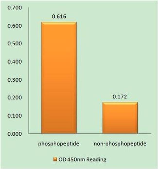 Phospho-IP3 Receptor 1 (Ser1588, Ser1598) Antibody