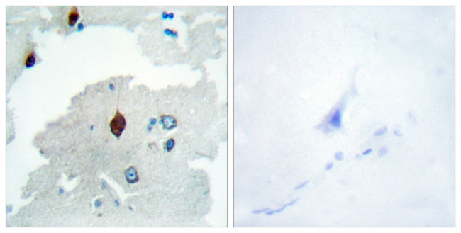 PTTG Antibody in Immunohistochemistry (Paraffin) (IHC (P))
