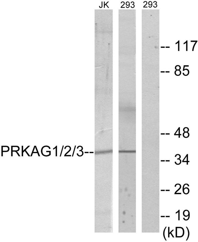 AMPK gamma-1,2,3 Antibody in Western Blot (WB)
