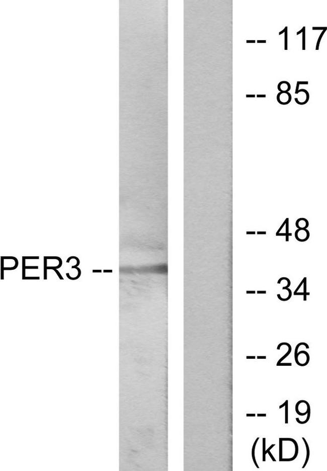 PER3 Antibody in Western Blot (WB)