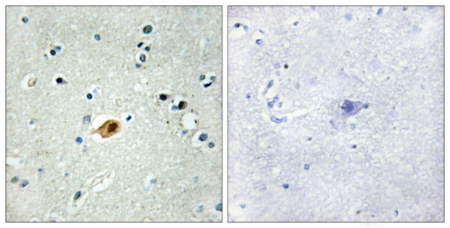 SOX8/SOX9/SOX17/SOX18 Antibody in Immunohistochemistry (Paraffin) (IHC (P))