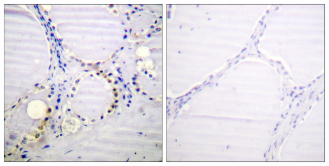 Phospho-Aconitase 1 (Ser711) Antibody in Immunohistochemistry (Paraffin) (IHC (P))