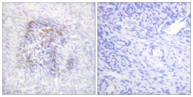 Phospho-Aconitase 1 (Ser138) Antibody in Immunohistochemistry (Paraffin) (IHC (P))