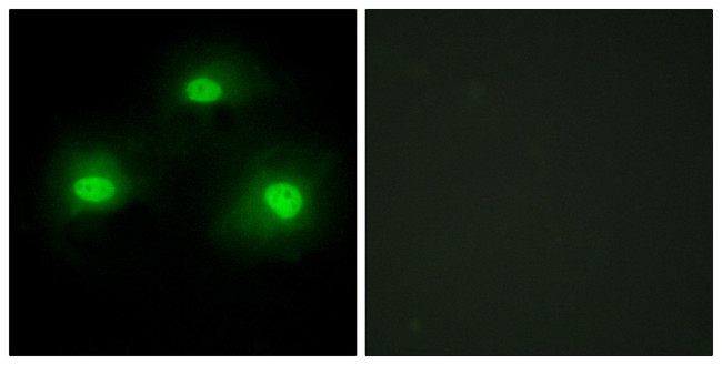 PKIA Antibody in Immunocytochemistry (ICC/IF)