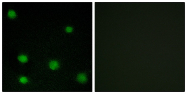 RBM6 Antibody in Immunocytochemistry (ICC/IF)