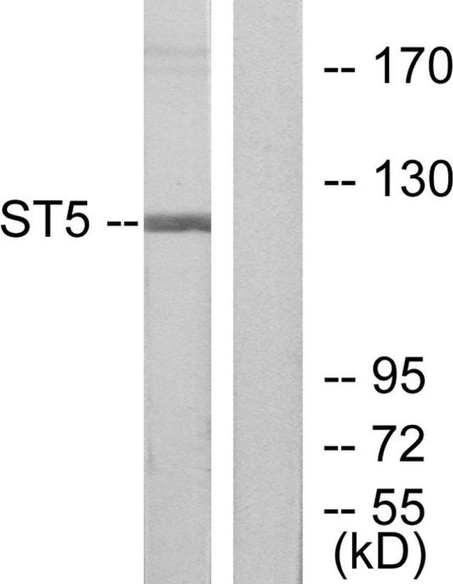 ST5 Antibody in Western Blot (WB)
