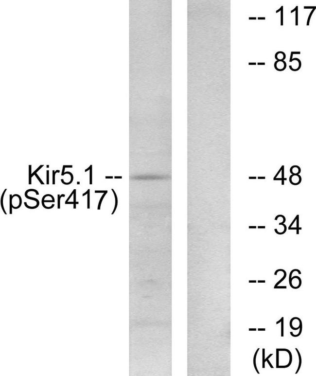 Phospho-Kir5.1 (Ser417) Antibody in Western Blot (WB)