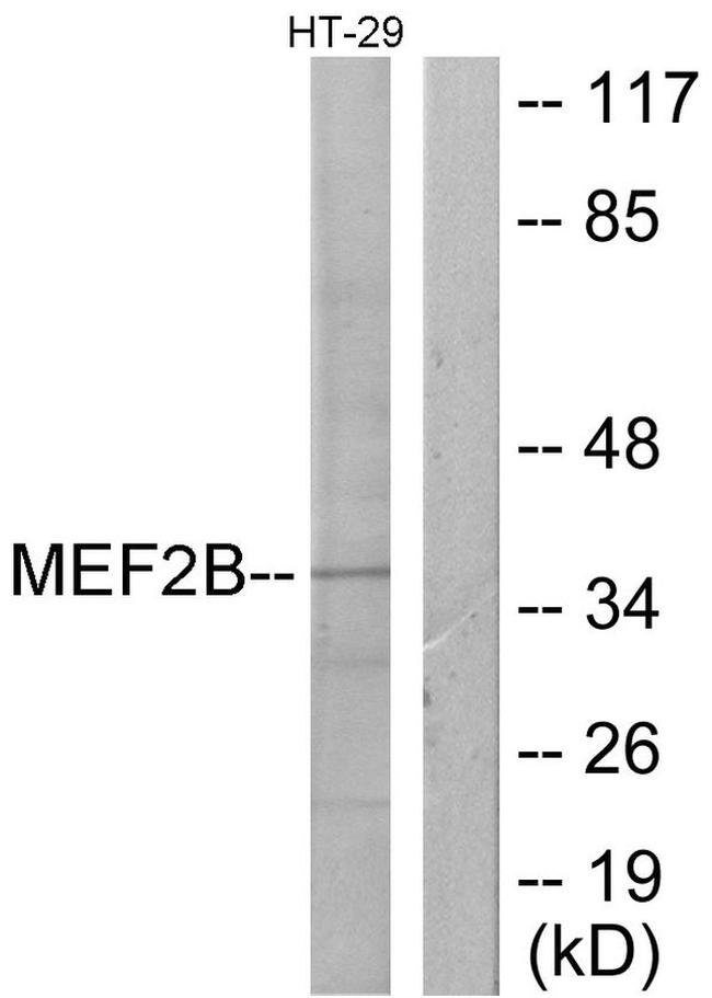 MEF2B Antibody in Western Blot (WB)