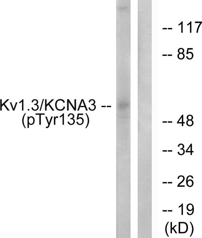 Phospho-KV1.3 (Tyr135) Antibody in Western Blot (WB)