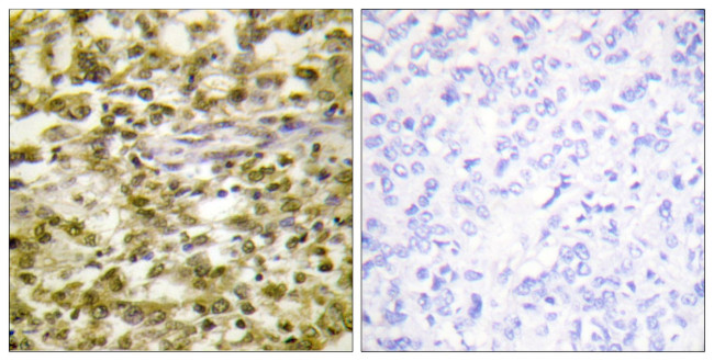 CSB Antibody in Immunohistochemistry (Paraffin) (IHC (P))