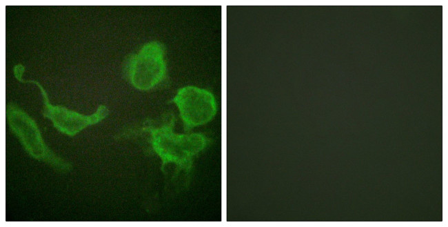 KV3.4 (KCNC4) Antibody in Immunocytochemistry (ICC/IF)