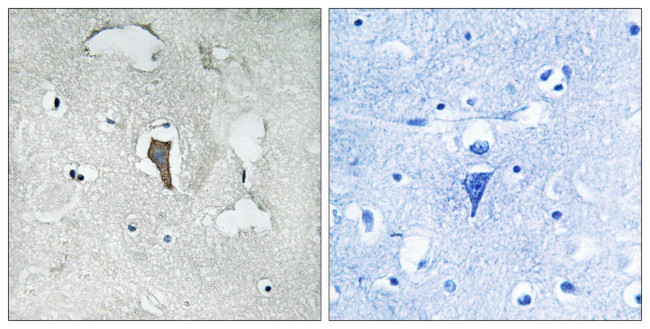 Phospho-KV4.2 (Ser616) Antibody in Immunohistochemistry (Paraffin) (IHC (P))