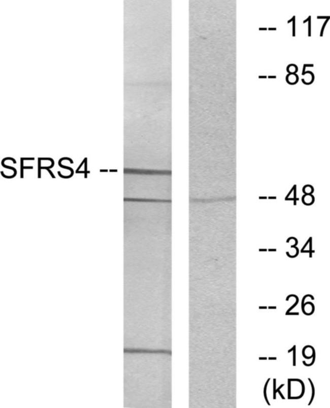 SRSF4 Antibody in Western Blot (WB)